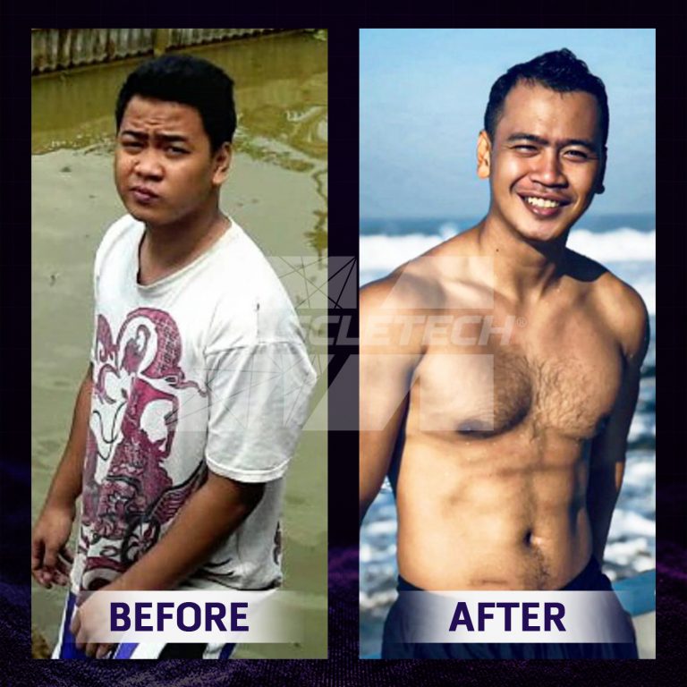 Before after Radit