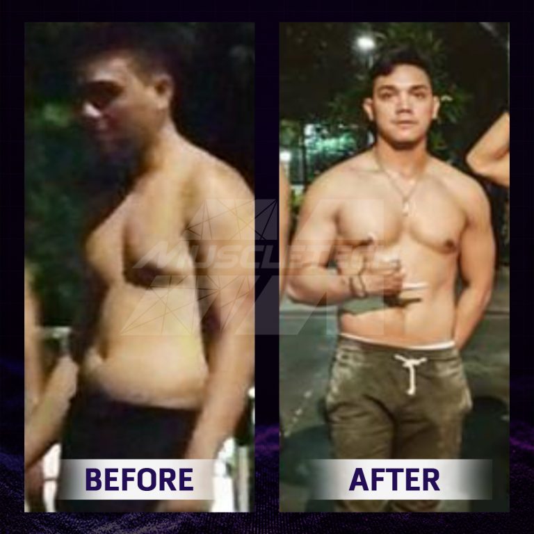 Before after Rendra