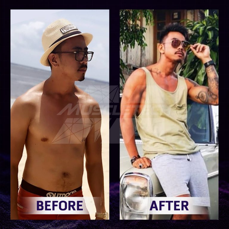 Before after Vano