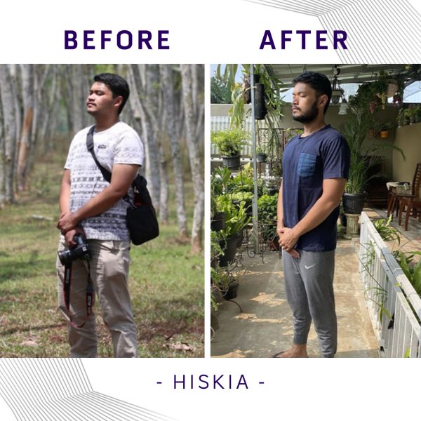 Hiskia
